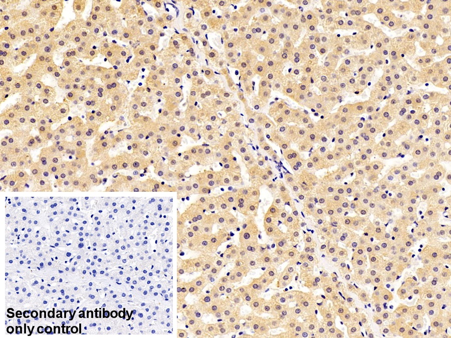 Polyclonal Antibody to Alpha-1-B-Glycoprotein (a1BG)