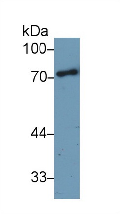 Polyclonal Antibody to Alpha-1-B-Glycoprotein (a1BG)