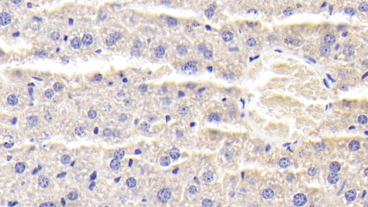 Polyclonal Antibody to Alpha-1-B-Glycoprotein (a1BG)