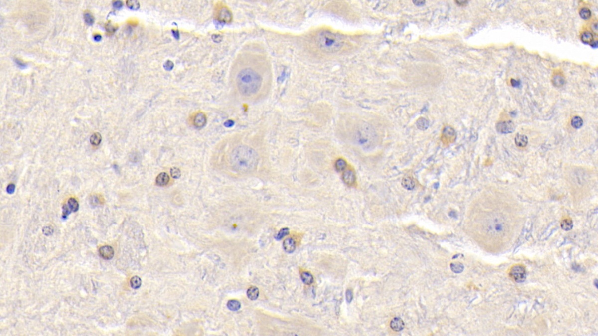 Polyclonal Antibody to Alpha-1-B-Glycoprotein (a1BG)