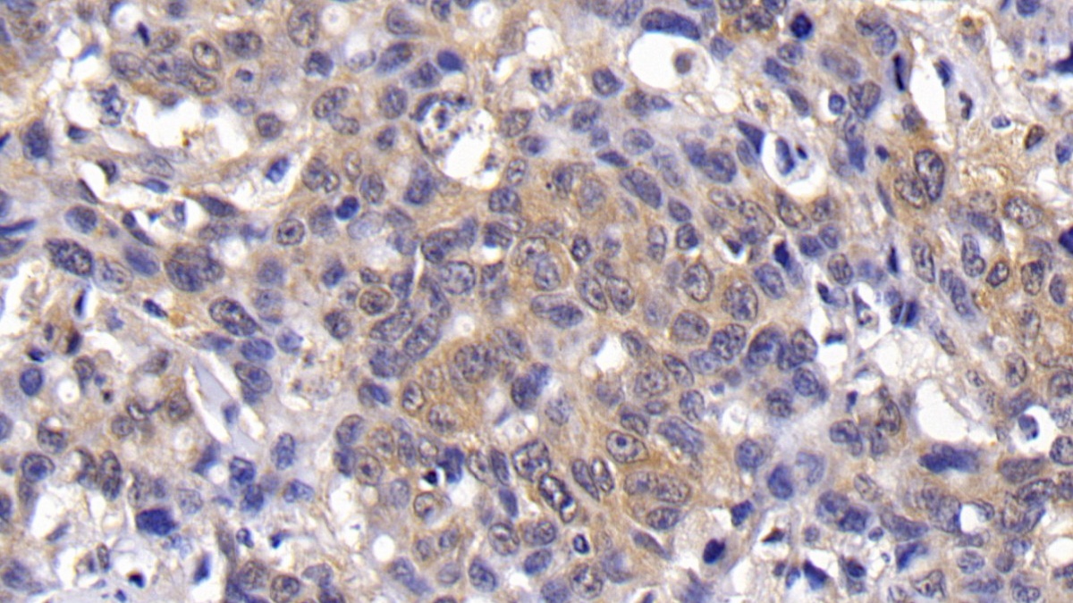 Polyclonal Antibody to B-Cell CLL/Lymphoma 2 Like Protein (Bcl2L)