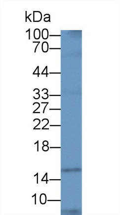 Polyclonal Antibody to Ubiquitin A 52 Residue Ribosomal Protein Fusion Product 1 (UBA52)