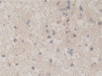 Polyclonal Antibody to Ubiquitin A 52 Residue Ribosomal Protein Fusion Product 1 (UBA52)