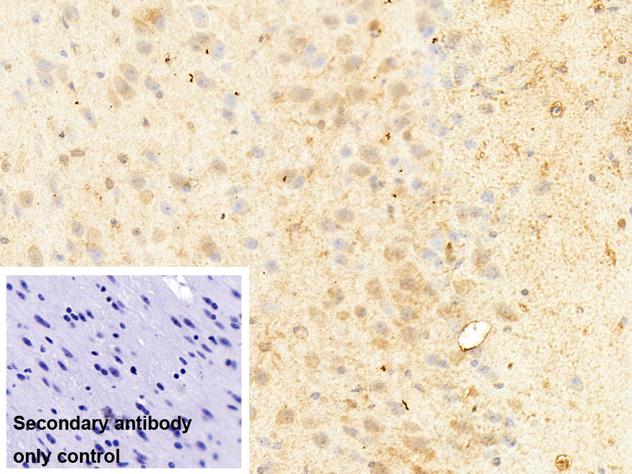 Polyclonal Antibody to Guanylate Binding Protein 2, Interferon Inducible (GBP2)
