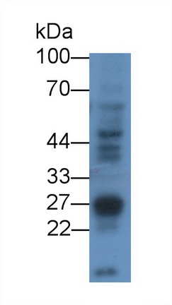 Polyclonal Antibody to Receptor Interacting Serine Threonine Kinase 3 (RIPK3)