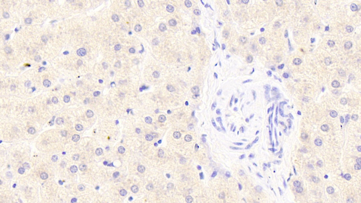 Polyclonal Antibody to Sphingosine 1 Phosphate Lyase 1 (SGPL1)