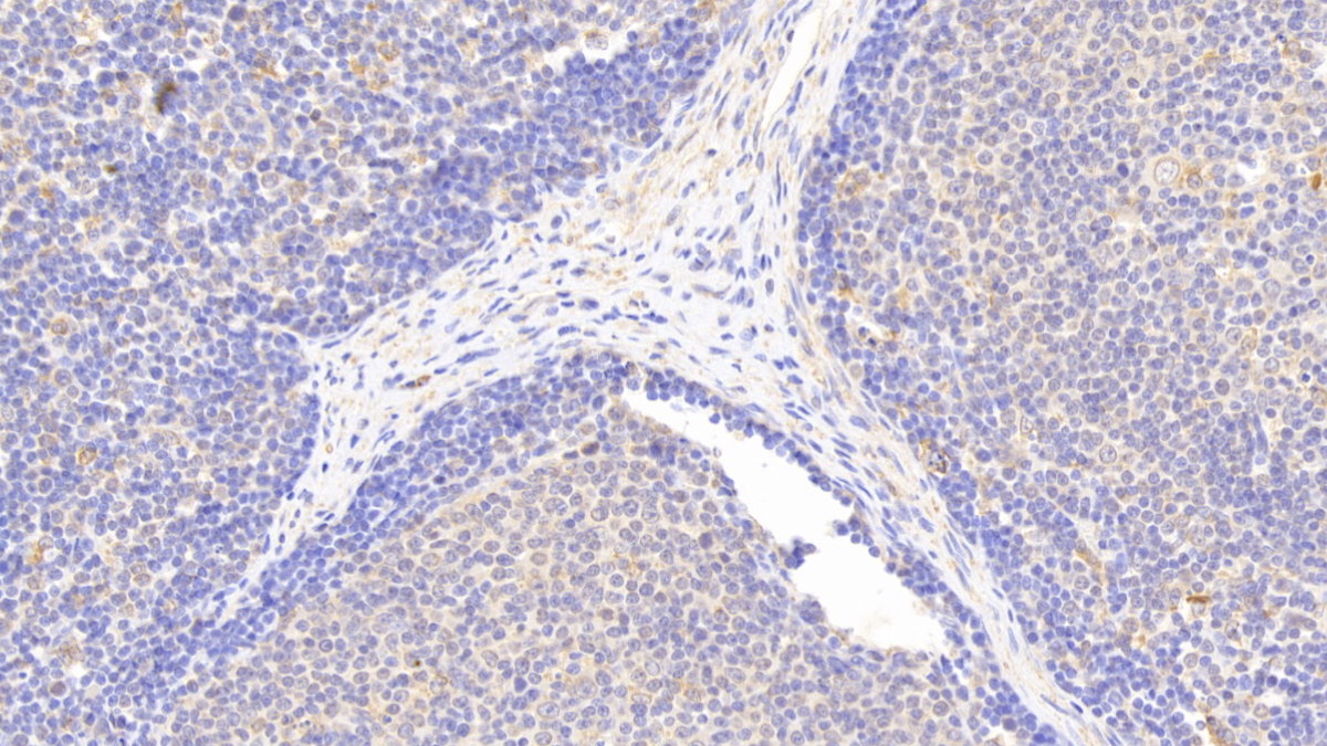 Polyclonal Antibody to Inhibitory Subunit Of NF Kappa B Epsilon (IkBe)
