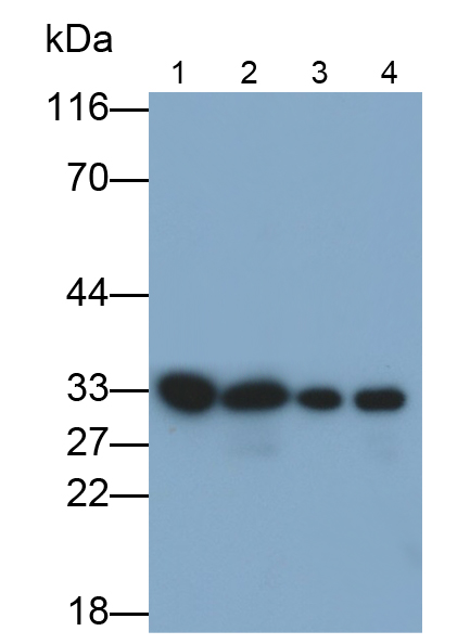 Polyclonal Antibody to Tubulin Folding Cofactor B (TBCB)