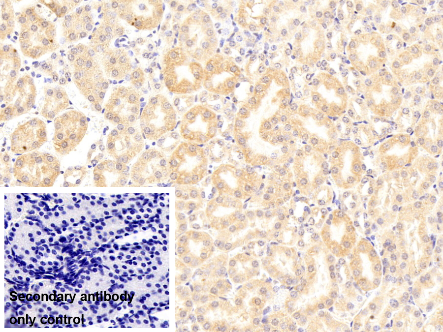 Polyclonal Antibody to Tubulin Folding Cofactor B (TBCB)