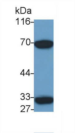 Polyclonal Antibody to Interleukin 20 Receptor Alpha (IL20Ra)