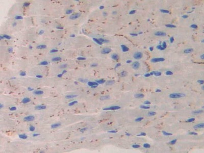 Polyclonal Antibody to Interleukin 11 Receptor Alpha (IL11Ra)