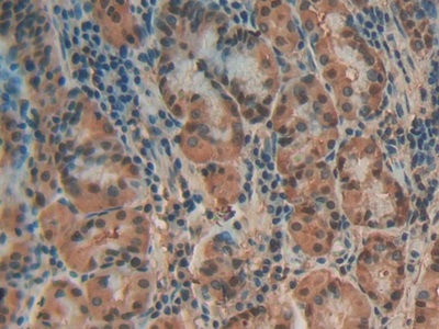 Polyclonal Antibody to Annexin A4 (ANXA4)