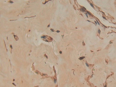 Polyclonal Antibody to Annexin A4 (ANXA4)