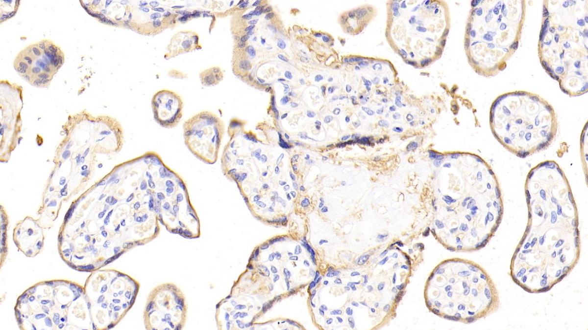 Polyclonal Antibody to Annexin A4 (ANXA4)