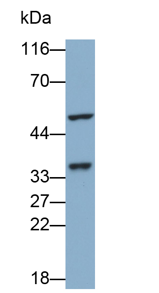 Polyclonal Antibody to Annexin A3 (ANXA3)
