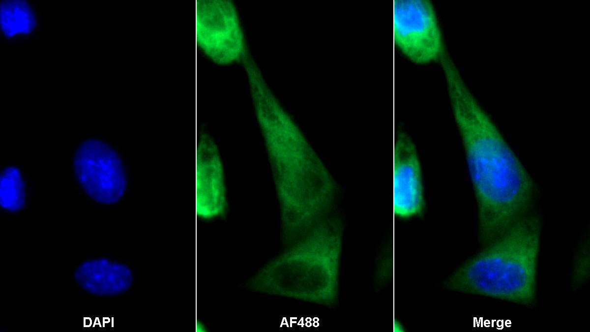 Polyclonal Antibody to Annexin A1 (ANXA1)