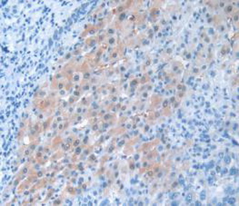 Polyclonal Antibody to Pannexin 1 (PANX1)