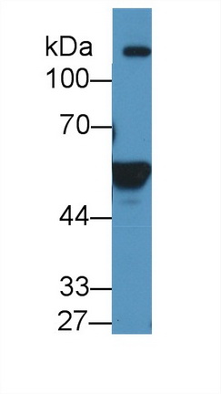 Polyclonal Antibody to Aldehyde Dehydrogenase 1 Family, Member A2 (ALDH1A2)