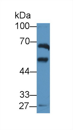 Polyclonal Antibody to Aldehyde Dehydrogenase 1 Family, Member A2 (ALDH1A2)