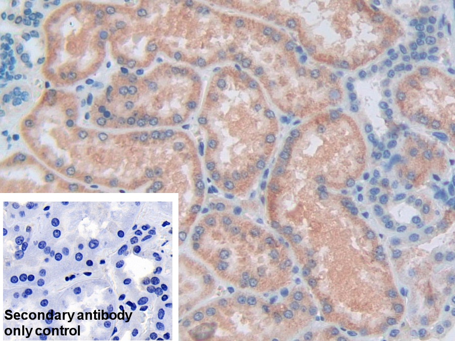 Polyclonal Antibody to Aldehyde Dehydrogenase 7 Family, Member A1 (ALDH7A1)