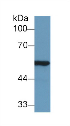 Polyclonal Antibody to Aldehyde Dehydrogenase 7 Family, Member A1 (ALDH7A1)