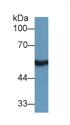 Polyclonal Antibody to Aldehyde Dehydrogenase 7 Family, Member A1 (ALDH7A1)