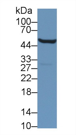 Polyclonal Antibody to Aldehyde Dehydrogenase 9 Family, Member A1 (ALDH9A1)