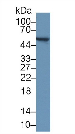 Polyclonal Antibody to Aldehyde Dehydrogenase 9 Family, Member A1 (ALDH9A1)