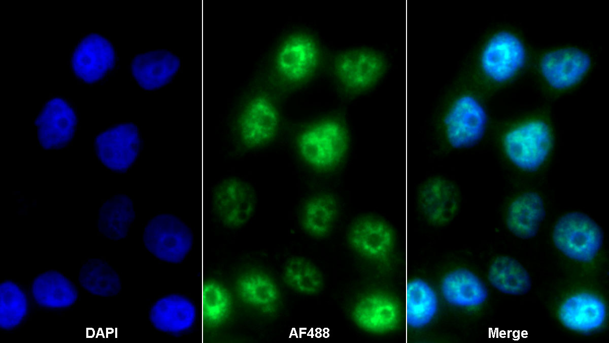 Polyclonal Antibody to Interleukin 1 Zeta (IL1z)