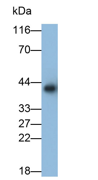 Polyclonal Antibody to Alcohol Dehydrogenase 2 (ADH2)