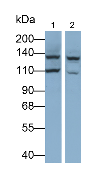 Polyclonal Antibody to Histone Deacetylase 6 (HDAC6)