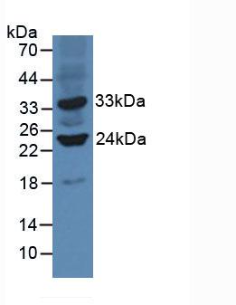 Polyclonal Antibody to Sirtuin 3 (SIRT3)