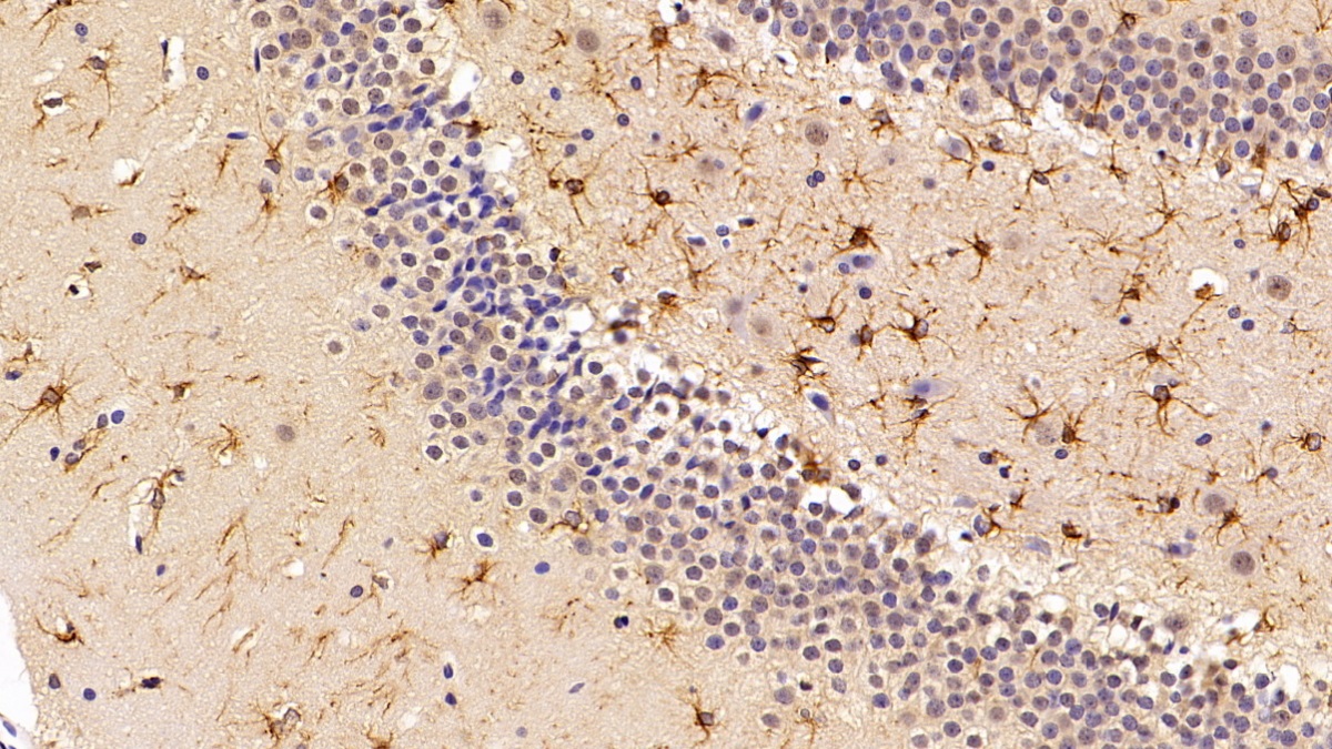 Polyclonal Antibody to Sirtuin 3 (SIRT3)