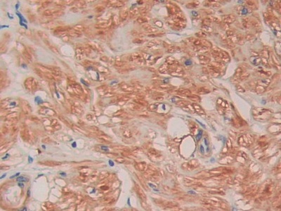 Polyclonal Antibody to Filamin C Gamma (FLNC)