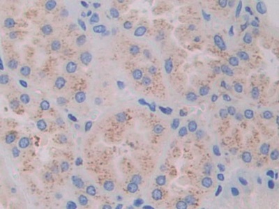 Polyclonal Antibody to Filamin C Gamma (FLNC)