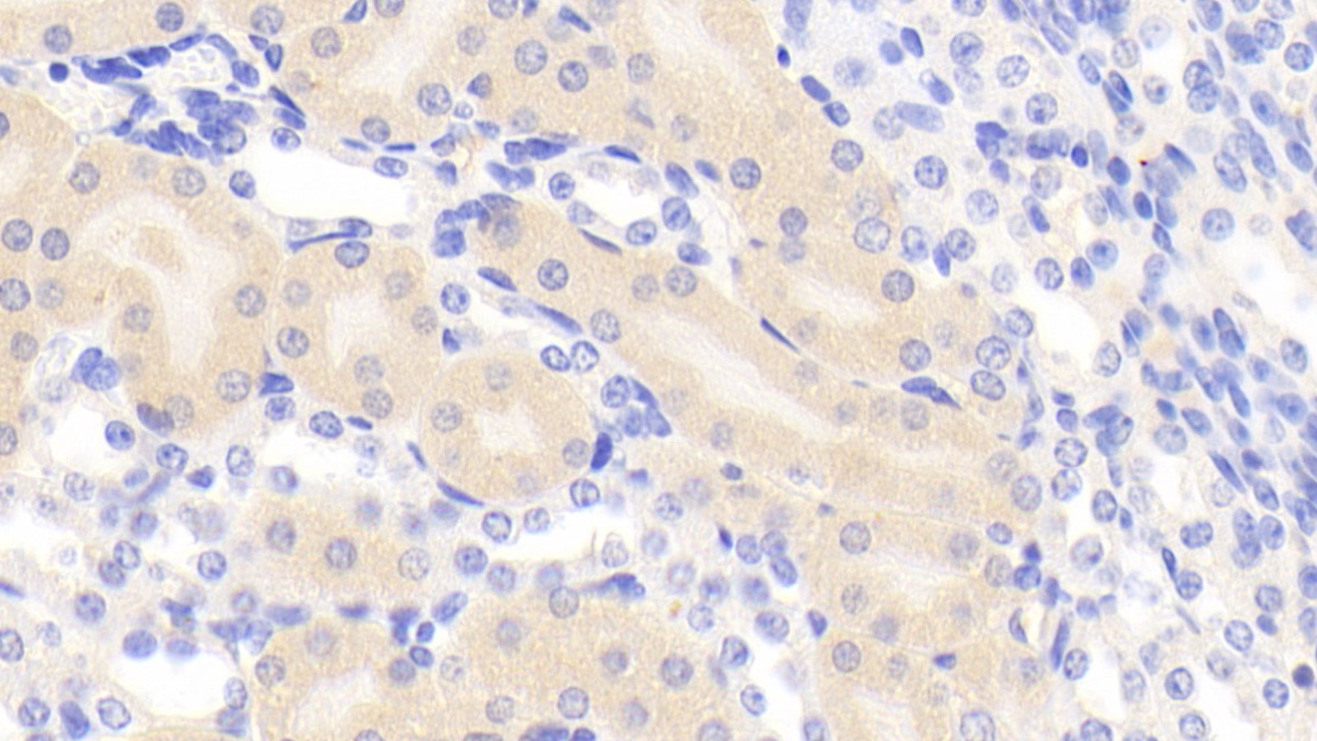 Polyclonal Antibody to Eukaryotic Translation Initiation Factor 2 Alpha Kinase 3 (EIF2aK3)