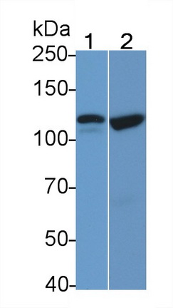 Polyclonal Antibody to Eukaryotic Translation Initiation Factor 2 Alpha Kinase 3 (EIF2aK3)