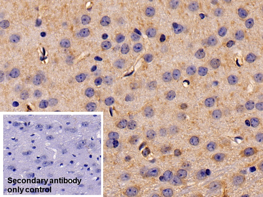 Polyclonal Antibody to Eukaryotic Translation Initiation Factor 2 Alpha Kinase 3 (EIF2aK3)