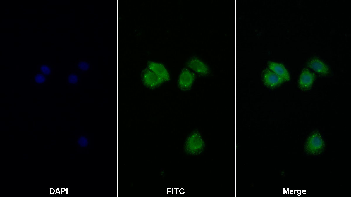 Polyclonal Antibody to Eukaryotic Translation Initiation Factor 2 Alpha Kinase 3 (EIF2aK3)