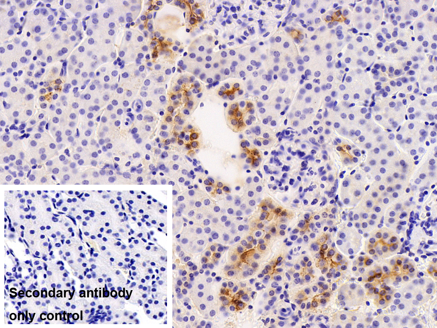 Polyclonal Antibody to Eukaryotic Translation Initiation Factor 4H (EIF4H)