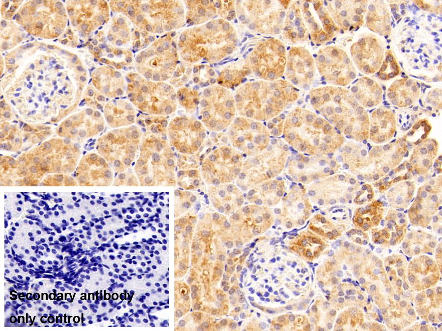 Polyclonal Antibody to Eukaryotic Translation Elongation Factor 1 Beta 2 (EEF1b2)