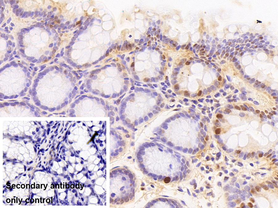 Polyclonal Antibody to Transcriptional Intermediary Factor 1 Beta (TIF1b)