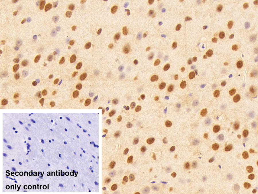 Polyclonal Antibody to Transcriptional Intermediary Factor 1 Beta (TIF1b)