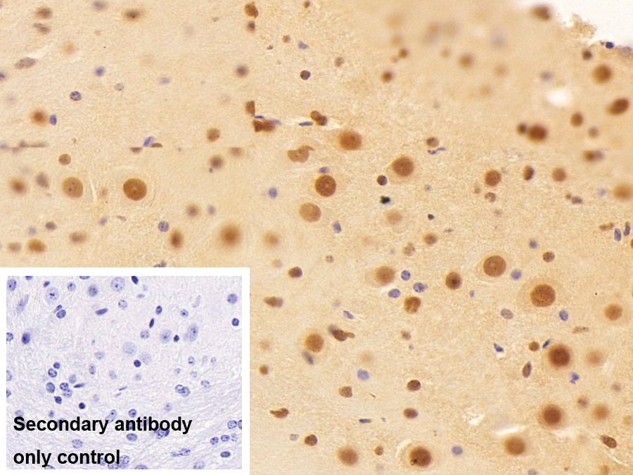 Polyclonal Antibody to Transcriptional Intermediary Factor 1 Beta (TIF1b)
