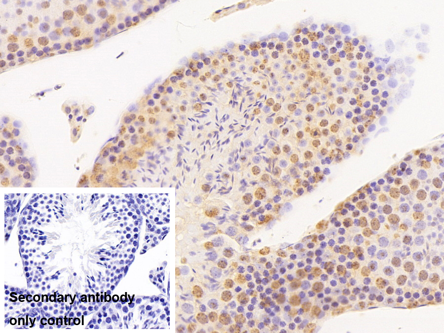 Polyclonal Antibody to Transcriptional Intermediary Factor 1 Beta (TIF1b)