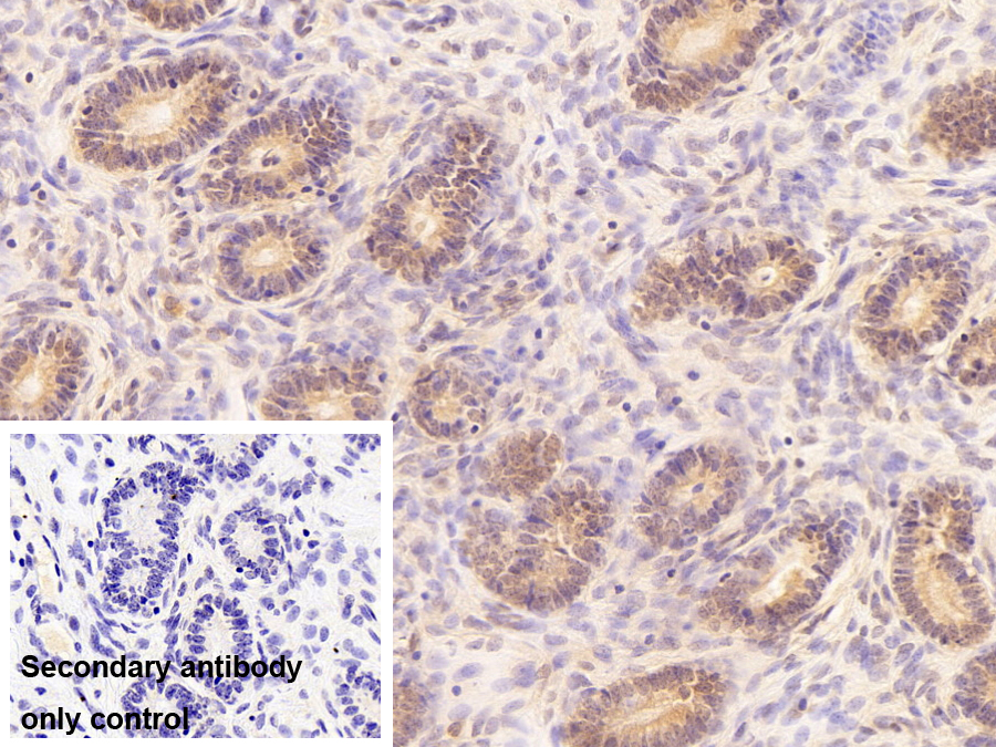 Polyclonal Antibody to Wilms Tumor Protein (WT1)