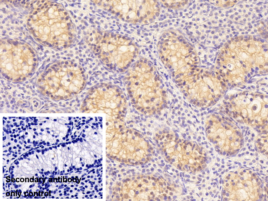 Polyclonal Antibody to Wilms Tumor Protein (WT1)
