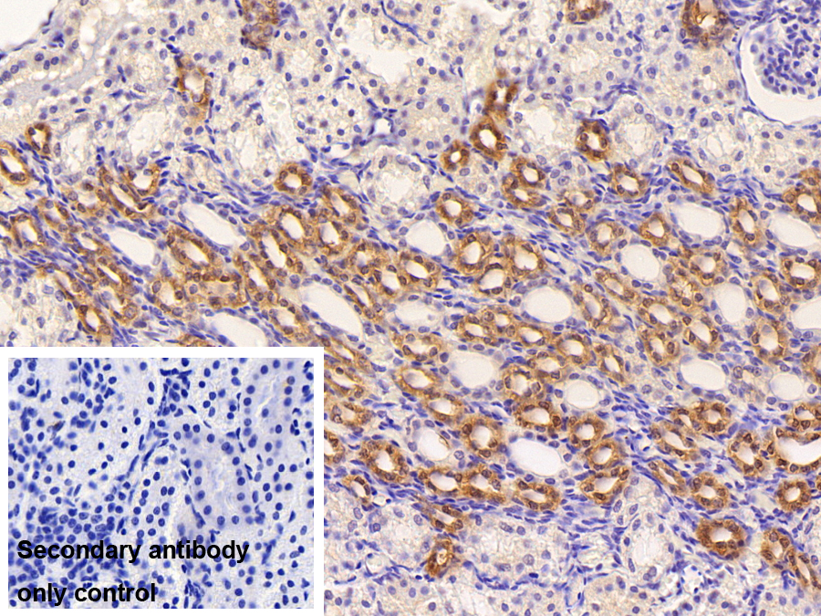 Polyclonal Antibody to Wilms Tumor Protein (WT1)