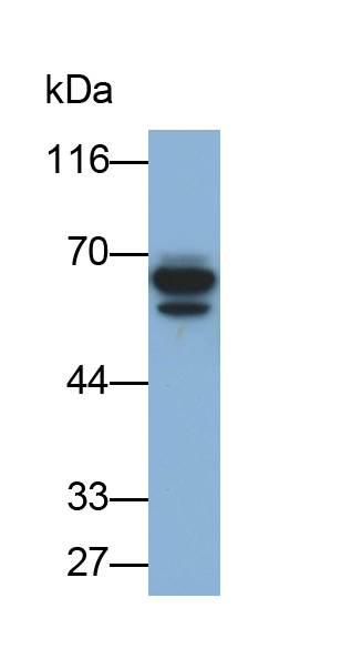 Polyclonal Antibody to Heterogeneous Nuclear Ribonucleoprotein K (HNRPK)