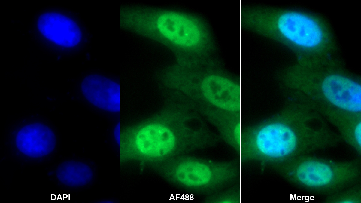 Polyclonal Antibody to Heterogeneous Nuclear Ribonucleoprotein K (HNRPK)